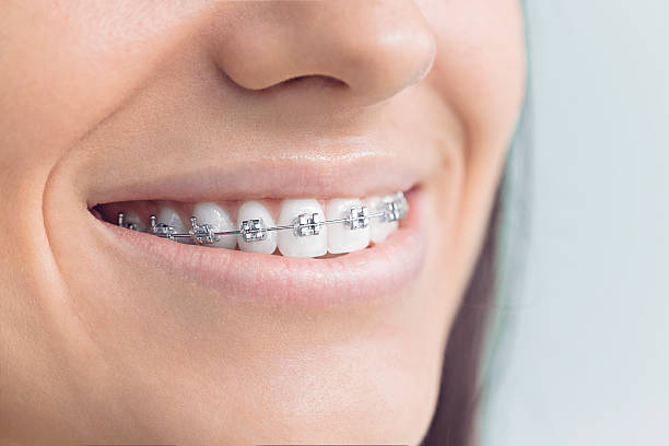Professional Dental Services in Avon Lake, OH